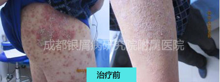 林绍泽2.jpg