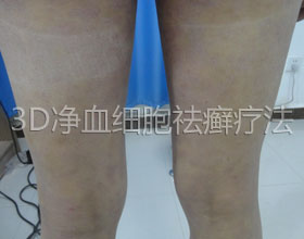 后.jpg