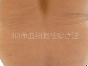 后.jpg
