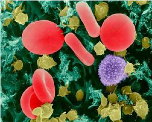 3D净血细胞祛癣疗法解析