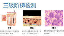 标准化治疗流程.jpg