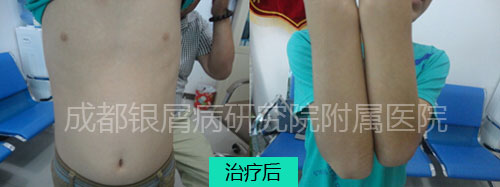 小孩后.jpg