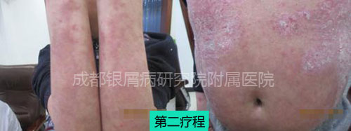 陈勇3.jpg