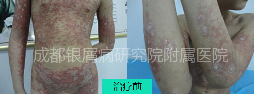 小孩前.jpg