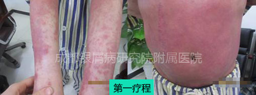 陈勇2.jpg