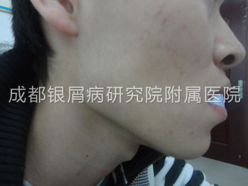 后.jpg
