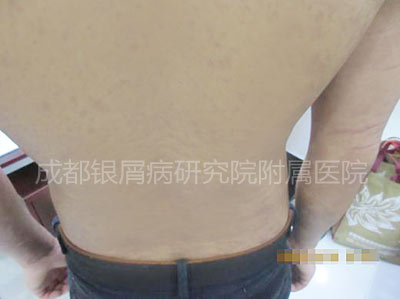 后背.jpg