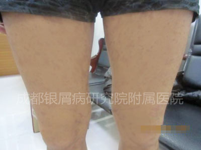 后腿.jpg