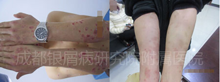伊林3.jpg