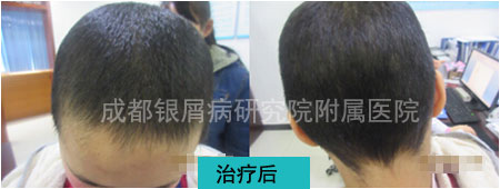 冉伊后1.jpg