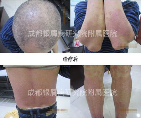 罗光友后.jpg