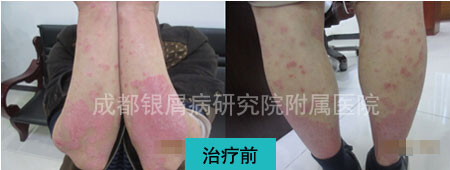 罗光友前2.jpg