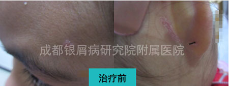 冉伊前1.jpg