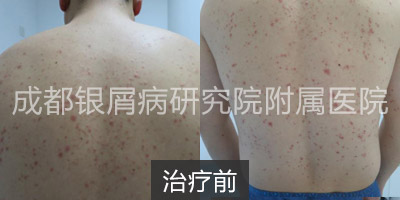 治疗前.jpg