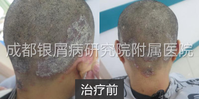 治疗前.jpg