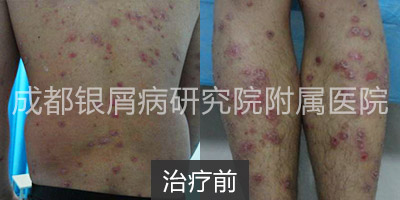 治疗前.jpg