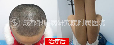 400-160-后.jpg