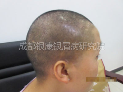 后.jpg