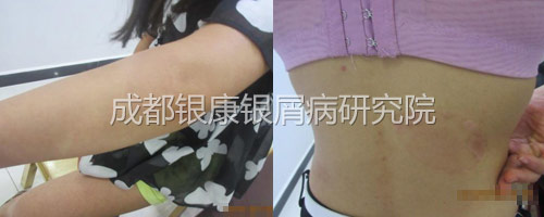 后.jpg