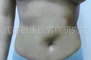 后.jpg