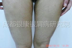 后-1.jpg